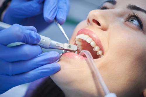 dental cleanings san clemente