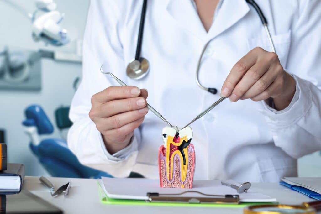 root canal therapy san clemente